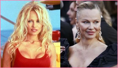 Why Does The Baywatch Star Look Unrecognizable These Days? The Actress Then and Now!